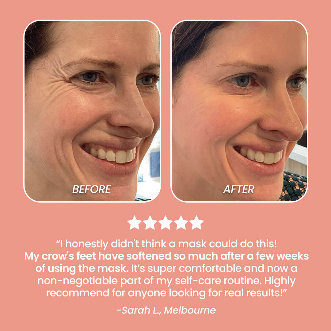 UltraRadiance™ LED Silicone Face Mask