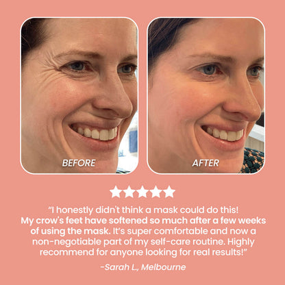 UltraRadiance™ LED Silicone Face Mask